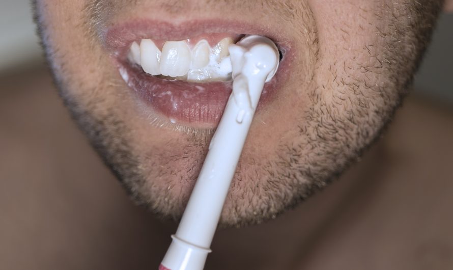 Ce simptome indică probleme de aliniere dentară